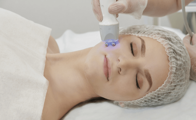 radiofrecuencia facial, ,radiofrecuencia